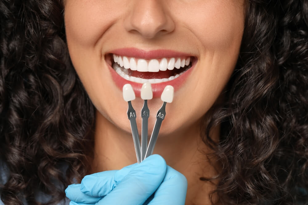 tooth color picking